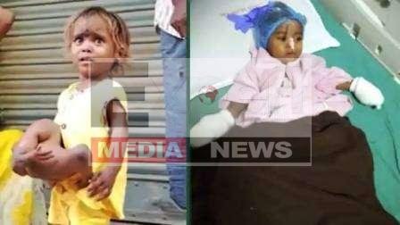 अभिनेता सोनू सूद ने नवादा के 4 हाथ-पैर वाली चौमुखी का सूरत में कराया सफल ऑपरेशन 1 Actor philanthropist Sonu Sood successfully operated four hand legged four legged from Nawada in Surat