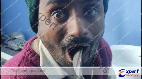 गोपालगंज : कुछ ऐसा किया कि मुंह में फंस गया छुरा, ऑपरेशन से बची जान 3 splinter got stuck in his mouth 1670210045