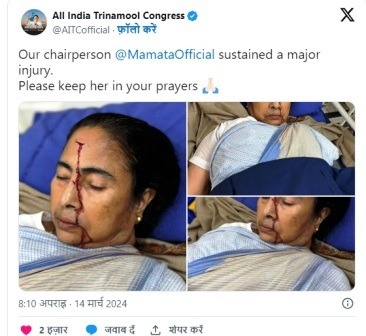 West Bengal CM Mamata Banerjee seriously injured admitted to hospital 1