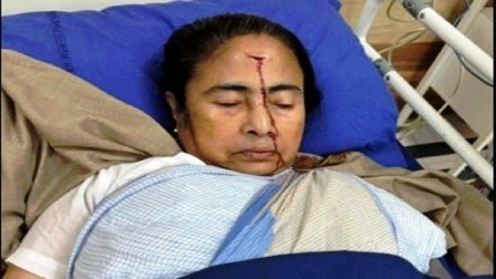 पश्चिम बंगाल की CM ममता बनर्जी गंभीर रुप से जख्मी,अस्पताल में भर्ती