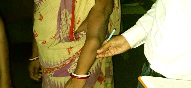 The dark chapter of Jadugoda Hundreds of lives are being lost in the glow of uranium 1