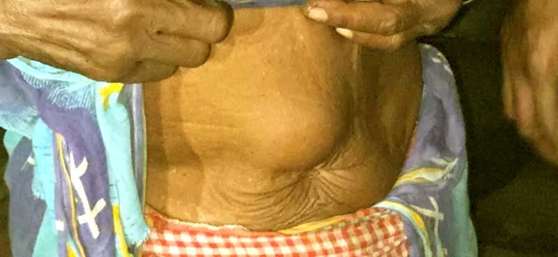 The dark chapter of Jadugoda Hundreds of lives are being lost in the glow of uranium 2