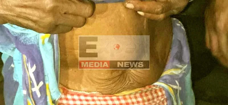 The dark chapter of Jadugoda Hundreds of lives are being lost in the glow of uranium 2
