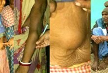 जादूगोड़ा का काला अध्याय: यूरेनियम की 'चमक' में यूं डूब रही हैं सैकड़ों जिंदगी 10 The dark chapter of Jadugoda Hundreds of lives are being lost in the glow of uranium 6