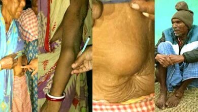 The dark chapter of Jadugoda Hundreds of lives are being lost in the glow of uranium 6