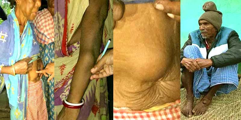 The dark chapter of Jadugoda Hundreds of lives are being lost in the glow of uranium 6