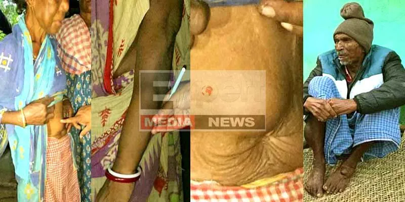 The dark chapter of Jadugoda Hundreds of lives are being lost in the glow of uranium 6